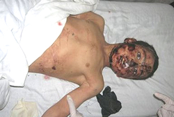 Nato victim 1 Nato victim 1