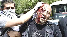 Turchia, la feroce repressione della polizia di Erdogan