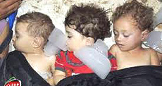 Bambini uccisi dai gas, le spaventose immagini che hanno invaso i media
