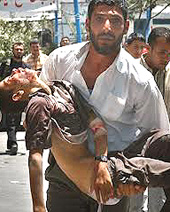 Bambini uccisi, il martirio di Gaza
